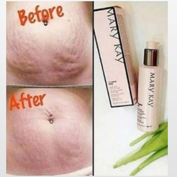 Time-wise Cellulite Body Cream Gel Female Beauty - Picture 7 of 9